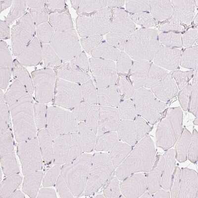 Immunohistochemistry-Paraffin: Enah/Vasp-like Antibody [NBP2-38132] - Staining of human skeletal muscle shows no positivity in myocytes as expected.