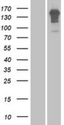 Western Blot: Enamelin Overexpression Lysate (Adult Normal) [NBP2-06111] Left-Empty vector transfected control cell lysate (HEK293 cell lysate); Right -Over-expression Lysate for Enamelin.