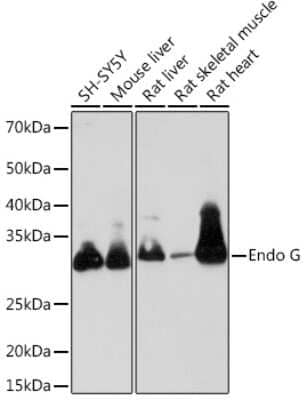 Western Blot: Endo G Antibody (4L7O4) [NBP3-16703] - Western blot analysis of extracts of various cell lines, using Endo G Rabbit mAb (NBP3-16703) at 1:1000 dilution. Secondary antibody: HRP Goat Anti-Rabbit IgG (H+L) at 1:10000 dilution. Lysates/proteins: 25ug per lane. Blocking buffer: 3% nonfat dry milk in TBST. Detection: ECL Basic Kit. Exposure time: 90s.
