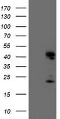 Western Blot: Endo G Antibody (5F1) [NBP2-01696] - HEK293T cells were transfected with the pCMV6-ENTRY control (Left lane) or pCMV6-ENTRY Endo G (Right lane) cDNA for 48 hrs and lysed. Equivalent amounts of cell lysates (5 ug per lane) were separated by SDS-PAGE and immunoblotted with anti-Endo G.