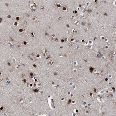 Immunohistochemistry-Paraffin: Endo G Antibody [NBP1-87554] - Staining of human cerebral cortex shows strong nuclear positivity in neurons and glial cells.