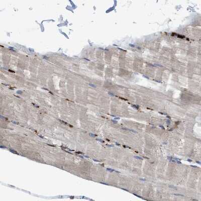 Immunohistochemistry-Paraffin: Endo G Antibody [NBP1-87554] - Staining of human skeletal muscle shows strong granular cytoplasmic positivity in myocytes.