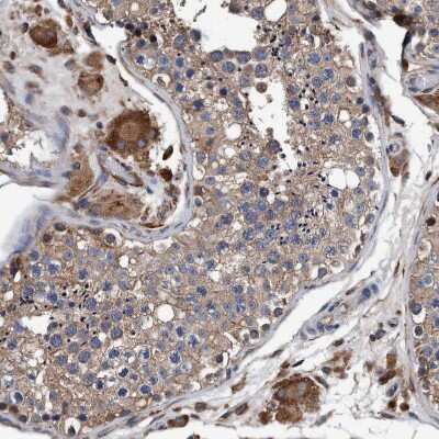 Immunohistochemistry-Paraffin: Endo G Antibody [NBP1-87554] - Staining of human testis shows strong granular cytoplasmic positivity in  Leydig cells.