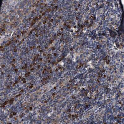 Immunohistochemistry-Paraffin: Endo G Antibody [NBP1-87554] - Staining of human tonsil shows strong granular cytoplasmic positivity in  non-germinal center cells.