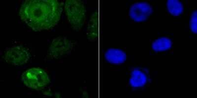 Immunocytochemistry/Immunofluorescence: Endo G Antibody (JU31-30) [NBP2-75480] - Staining Endo G in PC-3M cells (green). The nuclear counter stain is DAPI (blue). Cells were fixed in paraformaldehyde, permeabilised with 0.25% Triton X100/PBS.