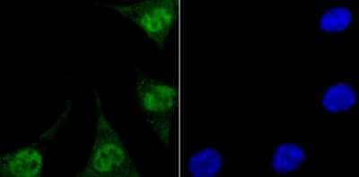 Immunocytochemistry/Immunofluorescence: Endo G Antibody (JU31-30) [NBP2-75480] - Staining Endo G in SH-SY5Y cells (green). The nuclear counter stain is DAPI (blue). Cells were fixed in paraformaldehyde, permeabilised with 0.25% Triton X100/PBS.