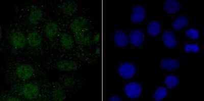 Immunocytochemistry/Immunofluorescence: Endo G Antibody (JU31-30) [NBP2-75480] - Staining Endo G in MCF-7 cells (green). The nuclear counter stain is DAPI (blue). Cells were fixed in paraformaldehyde, permeabilised