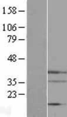 Western Blot: Endo G Overexpression Lysate (Adult Normal) [NBL1-10264] Left-Empty vector transfected control cell lysate (HEK293 cell lysate); Right -Over-expression Lysate for Endo G.