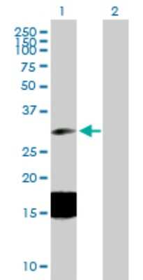 Western Blot: Endocan/ESM-1 Antibody [H00011082-B01P] - Analysis of ESM1 expression in transfected 293T cell line by ESM1 polyclonal antibody.  Lane 1: ESM1 transfected lysate(20.24 KDa). Lane 2: Non-transfected lysate.