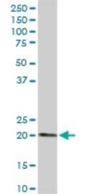 Western Blot: Endocan/ESM-1 Antibody [H00011082-D01P] - Analysis of ESM1 expression in human kidney.