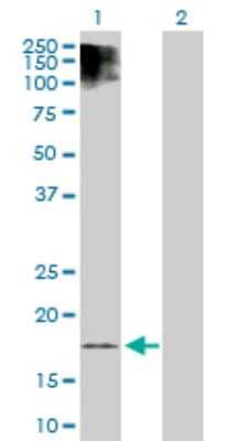 Western Blot: Endocan/ESM-1 Antibody [H00011082-D01P] - Analysis of ESM1 expression in transfected 293T cell line by ESM1 polyclonal antibody.Lane 1: ESM1 transfected lysate(20.10 KDa).Lane 2: Non-transfected lysate.