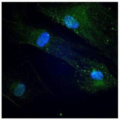 Immunocytochemistry/Immunofluorescence: Endoglin/CD105 Antibody (3A9) - Azide and BSA Free [NBP2-80719] - HMSC cells stained with anti-CD105 antibody. Image from verified customer review. Image from the standard format of this antibody.