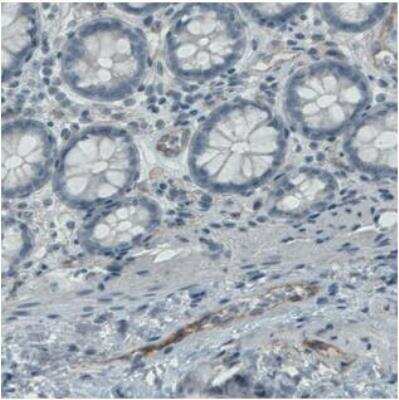 Immunohistochemistry-Paraffin: Endoglin/CD105 Antibody (CL1912) [NBP2-34493] - Staining of human colon shows moderate positivity in the endothelium of blood vessels.