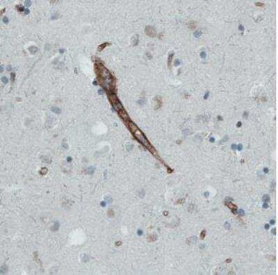 Immunohistochemistry-Paraffin: Endoglin/CD105 Antibody (CL1912) [NBP2-34493] - Staining of human cerebral cortex shows strong immunoreactivity in the blood vessels.
