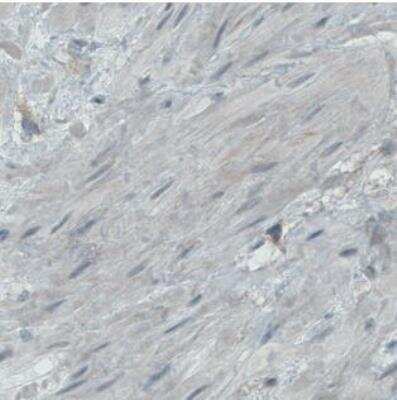 Immunohistochemistry-Paraffin: Endoglin/CD105 Antibody (CL1912) [NBP2-34493] - Staining of smooth muscle shows absence of positivity in myocytes (negative control).