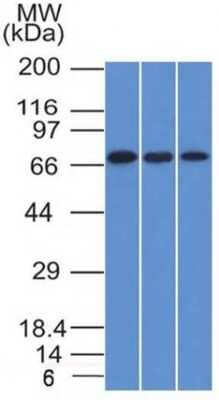 Western Blot: Endoglin/CD105 Antibody (ENG/1326) - Azide and BSA Free [NBP2-54518] - Western Blot of HeLa, A431 and HL-60 cell lysates with Endoglin/CD105 Monoclonal Antibody (ENG/1326).