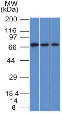 Western Blot: Endoglin/CD105 Antibody (ENG/1326) [NBP2-53327] - Western Blot of HeLa, A431 and HL-60 cell lysates with Endoglin / CD105 Monoclonal Antibody (ENG/1326).