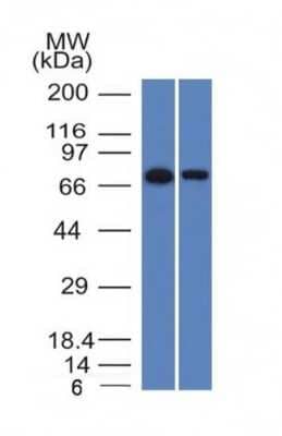 Western Blot: Endoglin/CD105 Antibody (ENG/1327) [NBP2-53334] - Western Blot of HeLa and A431 Cell Lysates with Endoglin / CD105 Monoclonal Antibody (ENG/1327).