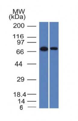 Western Blot: Endoglin/CD105 Antibody (ENG/1327) [NBP2-54517] - Western Blot of HeLa and A431 Cell Lysates with Endoglin / CD105 Monoclonal Antibody (ENG/1327).