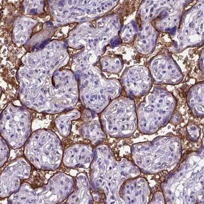 Immunohistochemistry: Endoglin/CD105 Antibody [NBP2-49516] - Staining of human placenta shows membranous positivity in trophoblasts.