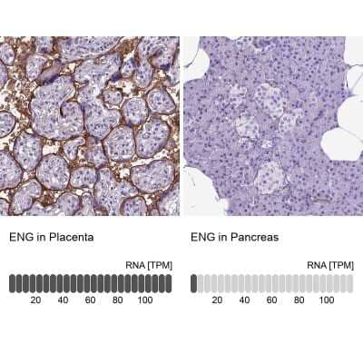 Immunohistochemistry-Paraffin: Endoglin/CD105 Antibody [NBP2-49516] - Analysis in human placenta and pancreas tissues. Corresponding ENG RNA-seq data are presented for the same tissues.