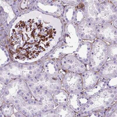 Immunohistochemistry-Paraffin: Endoglin/CD105 Antibody [NBP2-49516] - Staining of human kidney shows strong membranous positivity in cells in glomeruli.