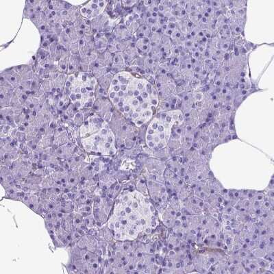 Immunohistochemistry-Paraffin: Endoglin/CD105 Antibody [NBP2-49516] - Staining of human pancreas shows low positivity in exocrine glandular cells as expected.