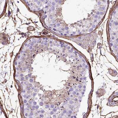 <b>Orthogonal Strategies Validation. </b>Immunohistochemistry-Paraffin: Endoglin/CD105 Antibody [NBP2-49516] - Staining of human testis shows moderate membranous positivity in peritubular myoid cells.