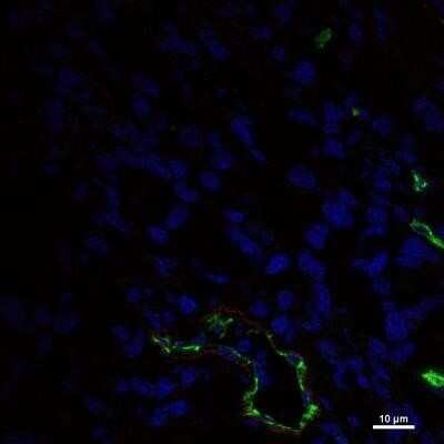 Immunocytochemistry/Immunofluorescence: Endoglin/CD105 Antibody (MJ7/18) - Azide and BSA Free [NBP2-80718] - Using the DyLight 550 direct conjugate Staining of CD105 (endoglin) in 4T1 tumors after radioimmunotherapy shows CD105 expression (red), blood vessels (green), and nuclei (blue).