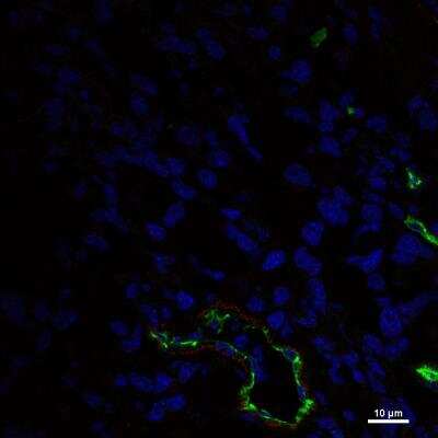 Immunohistochemistry-Frozen: Endoglin/CD105 Antibody (MJ7/18) [DyLight 550] [NB100-77666R] - Staining of CD105 (endoglin) in 4T1 tumors after radioimmunotherapy shows CD105 expression (red), blood vessels (green), and nuclei (blue).