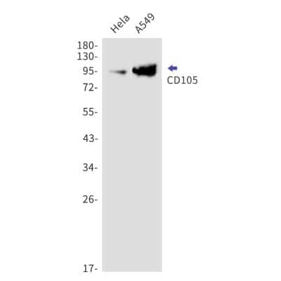 Western Blot: Endoglin/CD105 Antibody (S05-3H7) [NBP3-14875] - Western blot detection of Endoglin/CD105 in Hela, A549 cell lysates using Endoglin/CD105 Rabbit mAb (1:1000 diluted). Predicted band size: 71kDa. Observed band size: 95kDa.