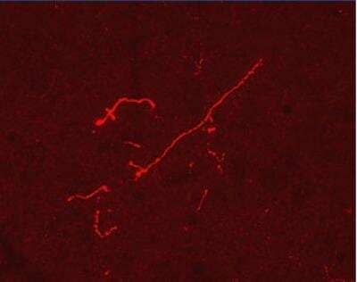 Immunocytochemistry/Immunofluorescence: Endomorphin 1 Antibody [NB100-1655] - Endomorphin-1staining in rat Peryaqueductal Grey Matter.