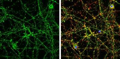 Immunocytochemistry/Immunofluorescence: Endophilin A1/SH3GL2 Antibody [NBP2-20345] - SH3GL2 antibody [N1C1] detects SH3GL2 protein by immunofluorescent analysis.Sample: DIV9 rat E18 primary cortical neurons cells were fixed in 4% paraformaldehyde at RT for 15 min. Green: SH3GL2 stained by SH3GL2 antibody [N1C1] diluted at 1:500. Red: beta Tubulin 3/ Tuj1, stained by beta Tubulin 3/ Tuj1 antibody [GT1338] diluted at 1:500. Blue: Fluoroshield with DAPI.