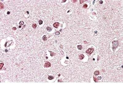 Immunohistochemistry-Paraffin: Endophilin A1/SH3GL2 Antibody [NBP2-26164] - Staining of Human Cerebral Cortex. Steamed antigen retrieval with citrate buffer pH 6, AP-staining.  