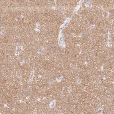 Immunohistochemistry-Paraffin: Endophilin A1/SH3GL2 Antibody [NBP2-38996] - Staining of human cerebral cortex shows high expression.