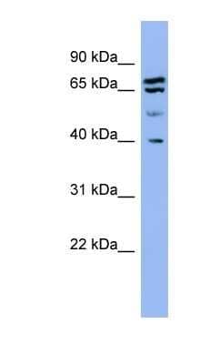 Western Blot: Endophilin A1/SH3GL2 Antibody [NBP1-79629] - Titration: 0.2-1 ug/ml, Positive Control: Hela cell lysate.