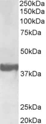 Western Blot: Endophilin A1/SH3GL2 Antibody [NBP2-26164] - Staining of Human Frontal Cortex lysate (35 ug protein in RIPA buffer). Primary incubation was 1 hour. Detected by chemiluminescence.  