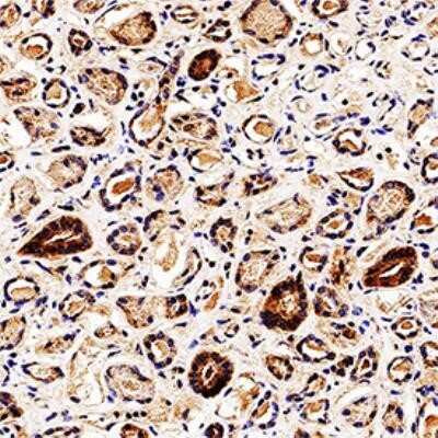 Immunohistochemistry-Paraffin: Endophilin B1/Bif-1 Antibody (30A882.1.1) - Azide Free [NBP2-33258] - IHC analysis of formalin fixed paraffin-embedded (FFPE) human kidney using 5 ug/ml conc. of Endophilin B1 antibody (clone 30A882.1.1) on a Bond Rx autostainer (Leica Biosystems). The assay involved 20 minutes of heat induced antigen retrieval (HIER) using 10mM sodium citrate buffer (pH 6.0) and endogenous peroxidase quenching with peroxide block. The sections were incubated with primary antibody for 30 minutes and Bond Polymer Refine Detection (Leica Biosystems) with DAB was used for signal development followed by counterstaining with hematoxylin. Whole slide scanning and capturing of representative images was performed using Aperio AT2 (Leica Biosystems). Cytoplasmic staining of Endophilin B1 was observed. Staining was performed by Histowiz. Image using the standard format of this product.