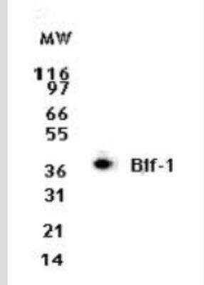 Western Blot: Endophilin B1/Bif-1 Antibody (30A882.1.1) - Azide Free [NBP2-33258] - Analysis for Bi-f-1/Endophilin-B1 using this antibody at 2 ug/ml dilution against 10 ug of Jurkat cell lysate.