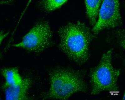 Immunocytochemistry/Immunofluorescence: Endophilin B1/Bif-1 Antibody [NBP1-31130] - Endophilin B1/Bif-1 antibody [C2C3], C-term detects Bif-1 protein at cytoplasm by immunofluorescent analysis.Sample: HeLa cells were fixed in 4% paraformaldehyde at RT for 10 min.Green: Bif-1 protein stained by Bif-1 antibody [C2C3], C-term (NBP1-31130).Blue: Hoechst 33342 staining.Scale bar = 10 um