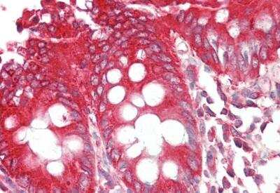 Immunohistochemistry-Paraffin: Endophilin B1/Bif-1 Antibody [NB100-820] - Staining of paraffin embedded Human Colon. Antibody at 2.5 ug/mL. Steamed antigen retrieval with citrate buffer pH 6, AP-staining.