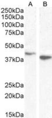 Western Blot: Endophilin B1/Bif-1 Antibody [NB100-820] - Staining of HEK293 (A) and A431 (B) cell lysate with antibody at 0.1 ug/mL. RIPA buffer, 35 ug total protein per lane. Detected by chemiluminescence.