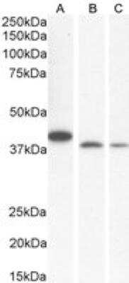 Western Blot: Endophilin B1/Bif-1 Antibody [NB100-820] - Staining of NIH3T3 (A), RAW264.7 (B) and KNRK (C) cell lysate with antibody at 0.1 ug/mL. RIPA buffer, 35 ug total protein per lane. Detected by chemiluminescence.