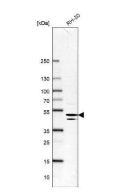 <b>Orthogonal Strategies Validation. </b>Western Blot: Endophilin B1/Bif-1 Antibody [NBP1-89972] - Analysis in human cell line RH-30.