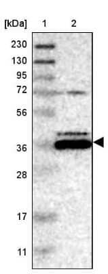 Western Blot: Endophilin B1/Bif-1 Antibody [NBP1-89973] - Lane 1: Marker  [kDa] 230, 130, 95, 72, 56, 36, 28, 17, 11.  Lane 2: Human cell line RT-62