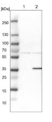 Western Blot: Endophilin B1/Bif-1 Antibody [NBP1-89973] - Lane 1: NIH-3T3 cell lysate (Mouse embryonic fibroblast cells). Lane 2: NBT-II cell lysate (Rat Wistar bladder tumor cells).