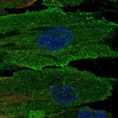 Immunocytochemistry/Immunofluorescence: Endosialin/CD248/TEM1 Antibody [NBP2-14462] - Staining of human cell line ASC TERT1 shows localization to nucleoplasm & plasma membrane. Antibody staining is shown in green.