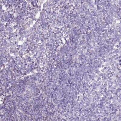 Immunohistochemistry-Paraffin: Endosialin/CD248/TEM1 Antibody [NBP2-14462] - Staining of human tonsil shows low expression as expected.