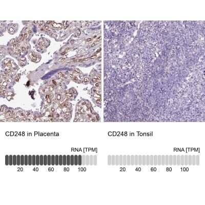 <b>Orthogonal Strategies Validation. </b>Immunohistochemistry-Paraffin: Endosialin/CD248/TEM1 Antibody [NBP2-14462] - Staining in human placenta and tonsil tissues using anti-CD248 antibody. Corresponding CD248 RNA-seq data are presented for the same tissues.