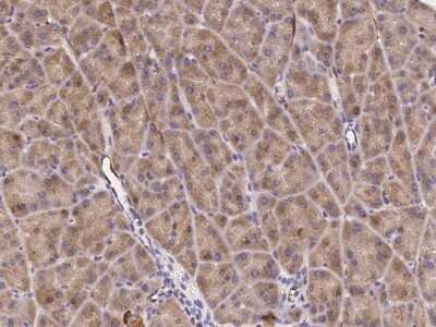 Immunohistochemistry-Paraffin: Endosialin/CD248/TEM1 Antibody [NBP2-99057] - Staining of mouse Endosialin/CD248/TEM1 in mouse pancreas with rabbit polyclonal antibody (1:1000).